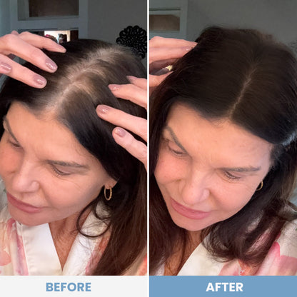 Slimoly® Instant Hair Coverage Powder