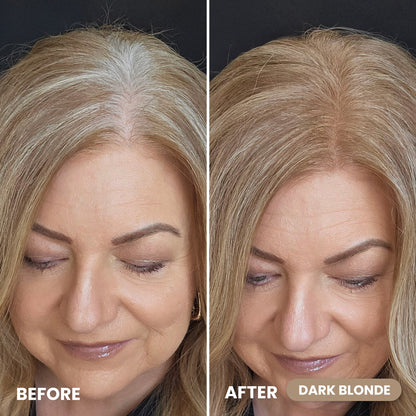 Slimoly® Instant Hair Coverage Powder