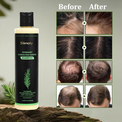 🔥LAST DAY 50% OFF - Slimoly® Organic Rosemary Hair Growth Shampoo